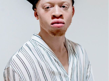 &quot;Albi X&quot;: Be different!